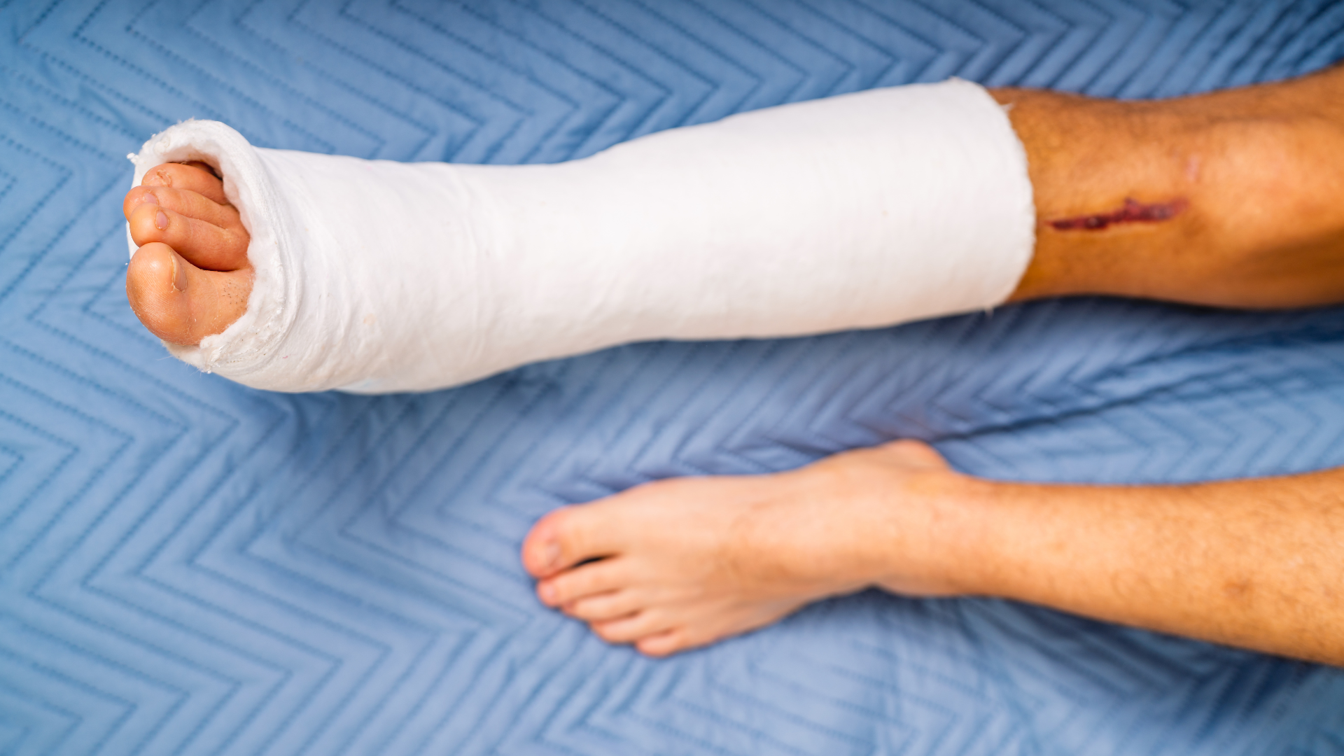 North Phoenix Rollover Crash Temporarily Blocks Major Freeway